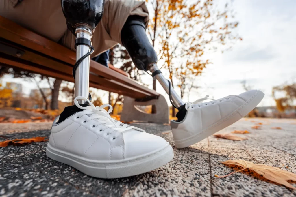 person adjusting to prosthetics after getting funding